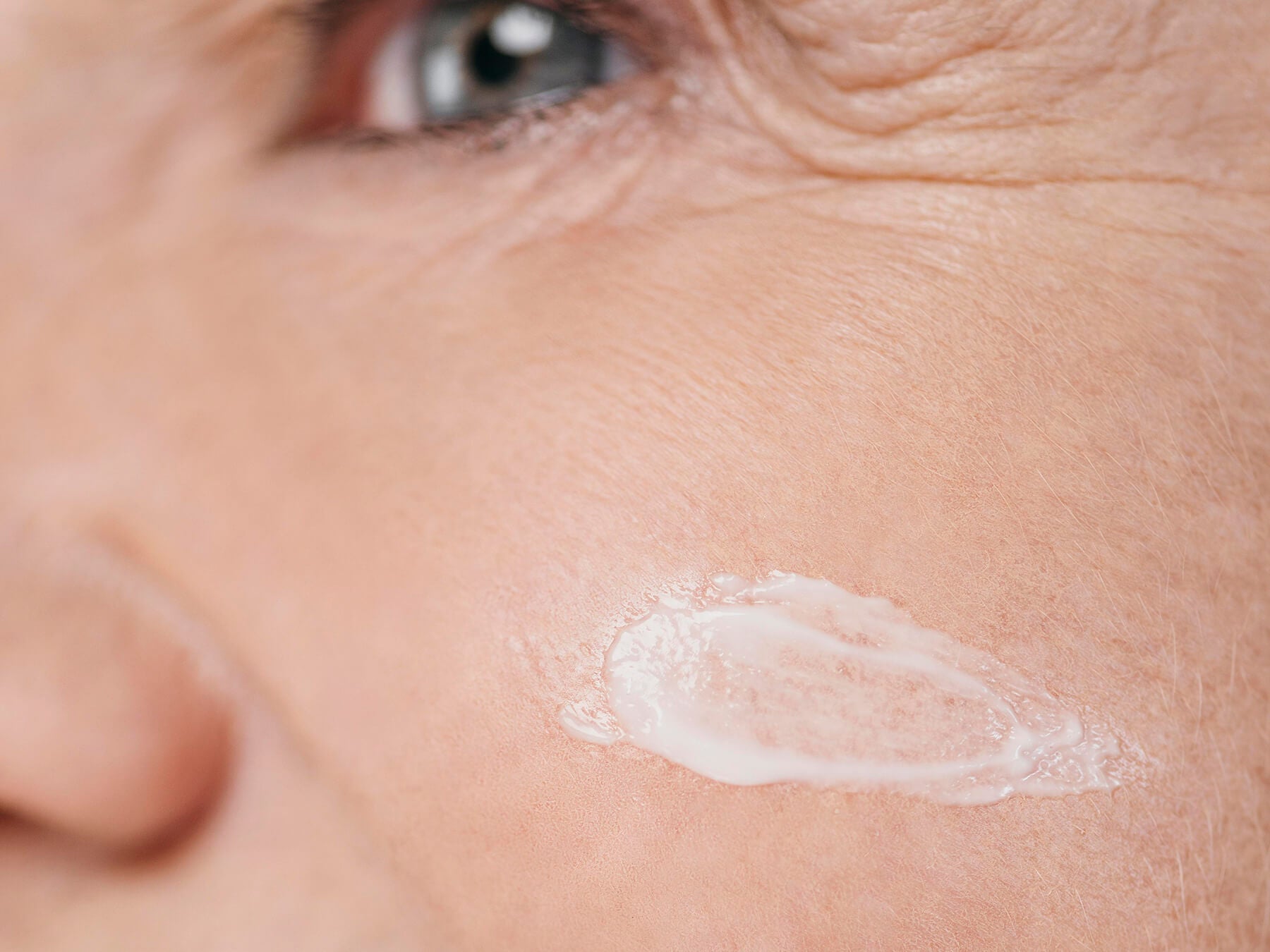 ACNE ED IMPERFEZIONI