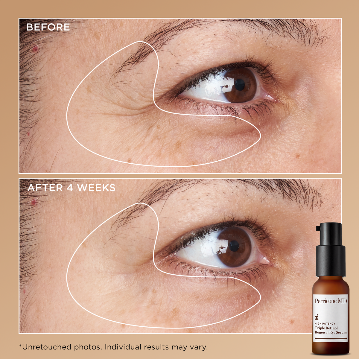 HIGH POTENCY Triple Retinol Power Kit Set routine completa al triplo Retinolo 3 prodotti