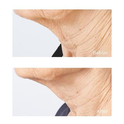 COLD PLASMA PLUS+ Sub-D/Neck Crema collo 59 ml