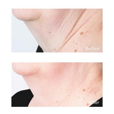 COLD PLASMA PLUS+ Sub-D/Neck Crema collo 59 ml