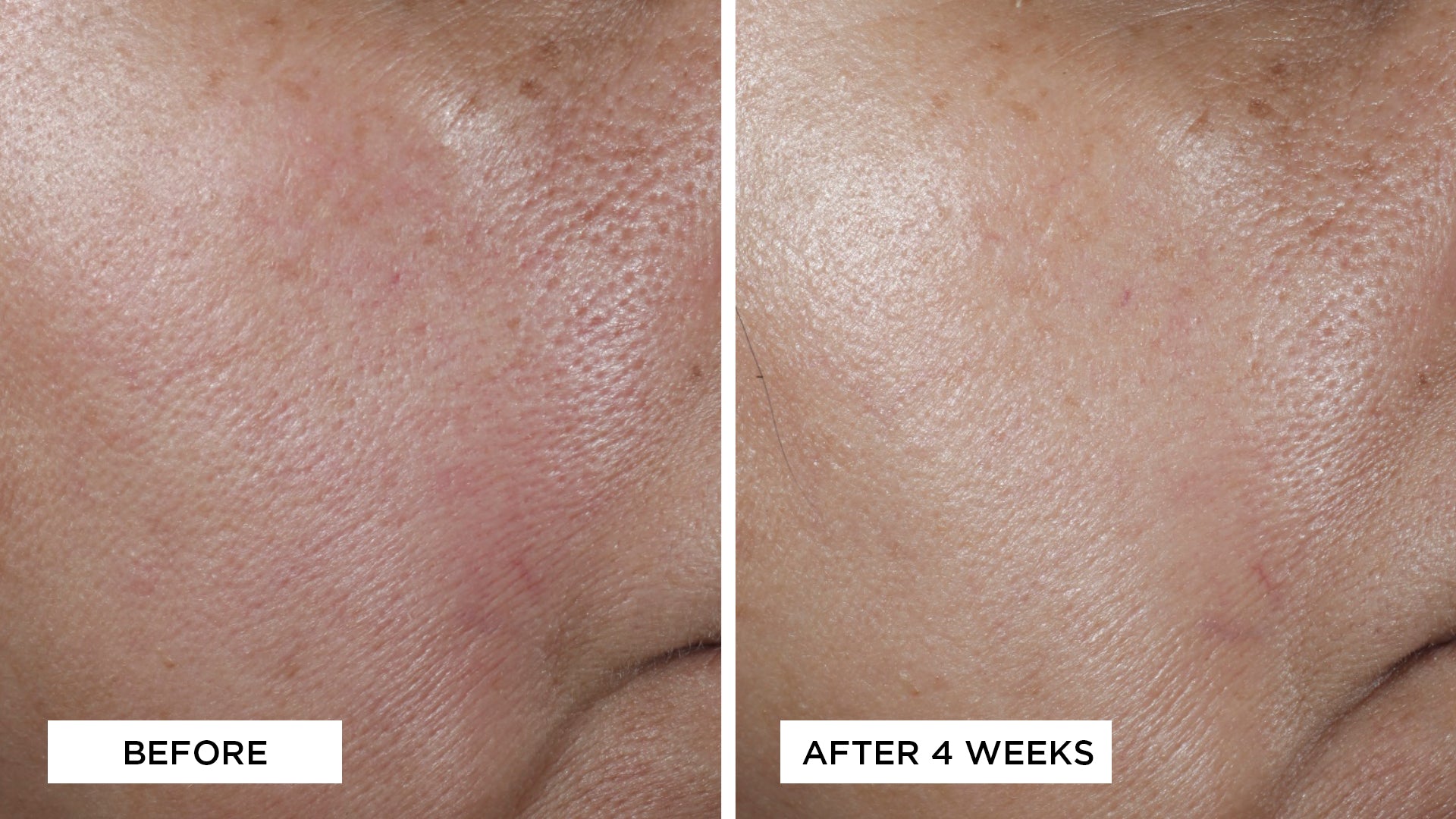 NO:RINSE Intensive Pore Minimizing Toner Tonico 118 ml