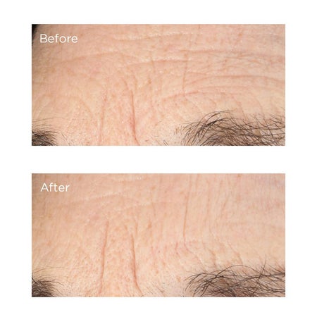 Essential Fx Acyl-Glutathione: Deep Crease Serum - Outlet Immagine 3