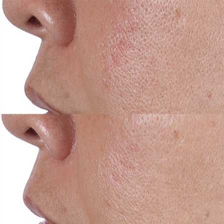 High Potency Face Finishing & Firming Toner Immagine 3