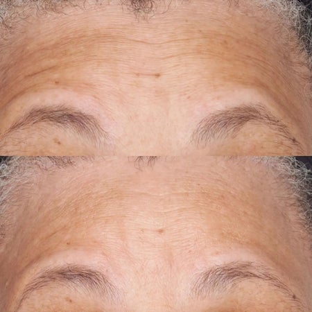 Hypoallergenic Clean Correction Barrier Repair Nourishing Moisturiser Immagine 3