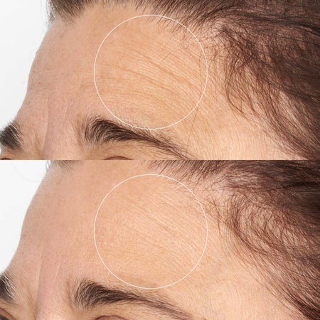 High Potency Intensive Niacinamide-rich Smoothing Serum Immagine 4