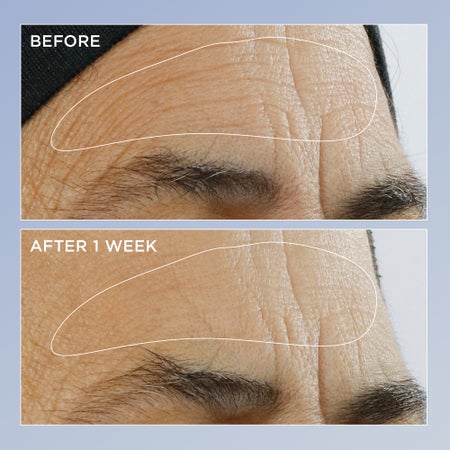 High Potency Retinol Renewal Serum Immagine 1